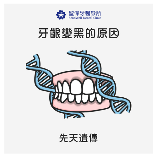 牙齦變黑的原因：先天遺傳